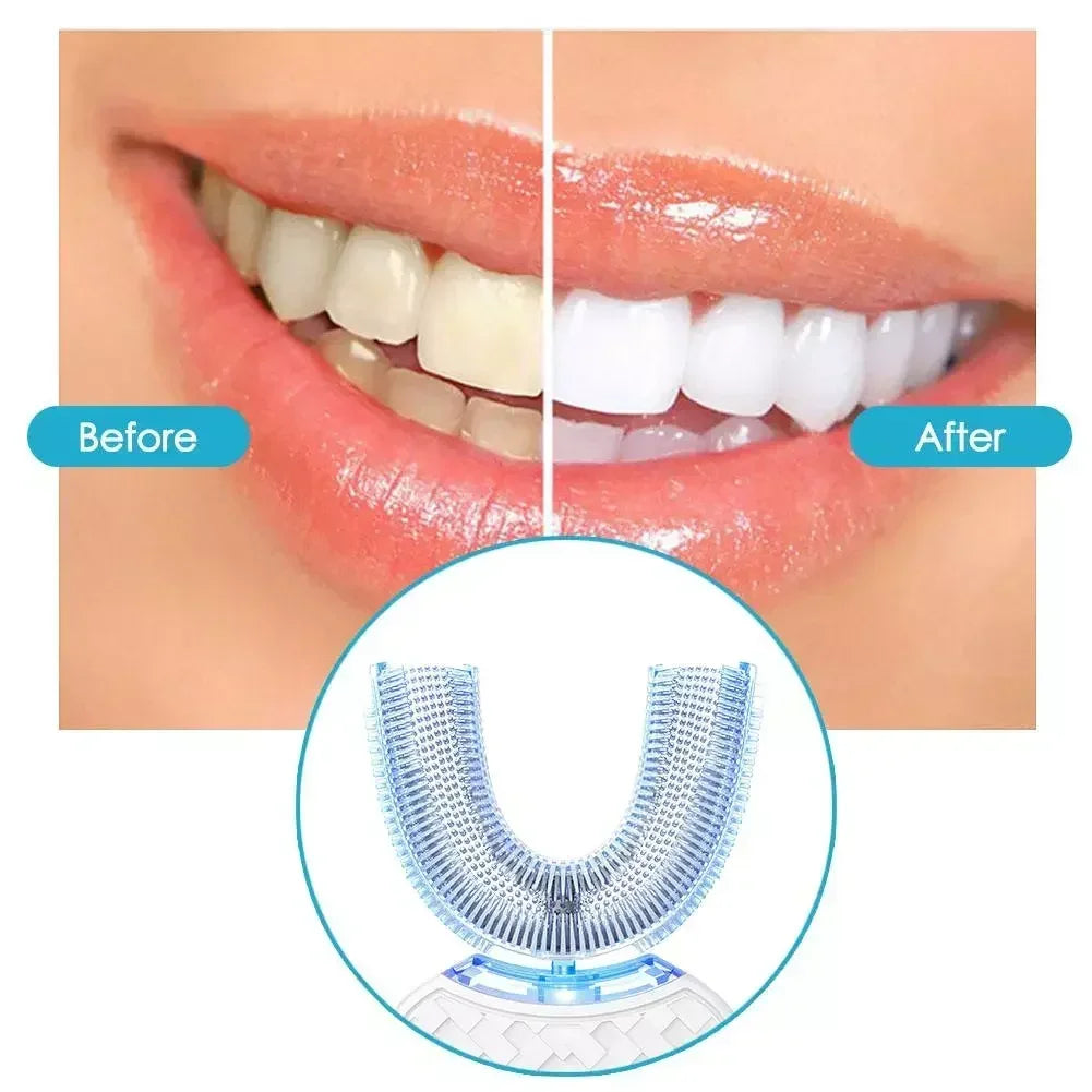 Ultrasonic Electric Toothbrush Adult, Automatic U-Shape Full Mouth 360° Clean Teeth Whitening IPX7 Waterproof